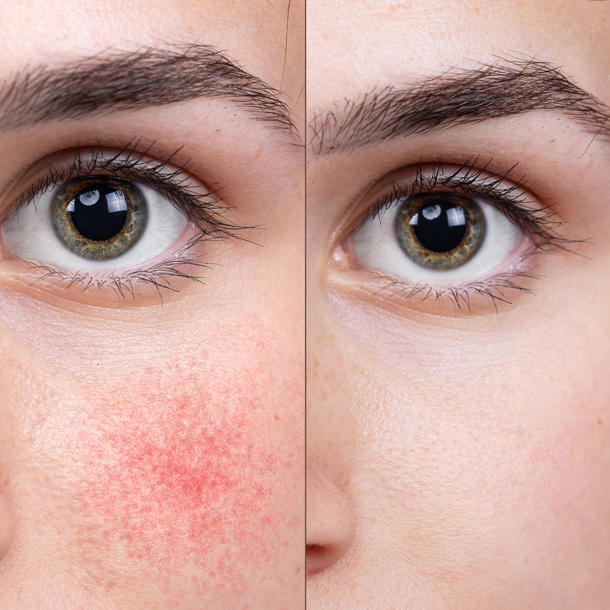 Belamax Sensitive Repair 24h Cream | 50ml | Beruhigende Pflege für empfindliche, irritierte Haut