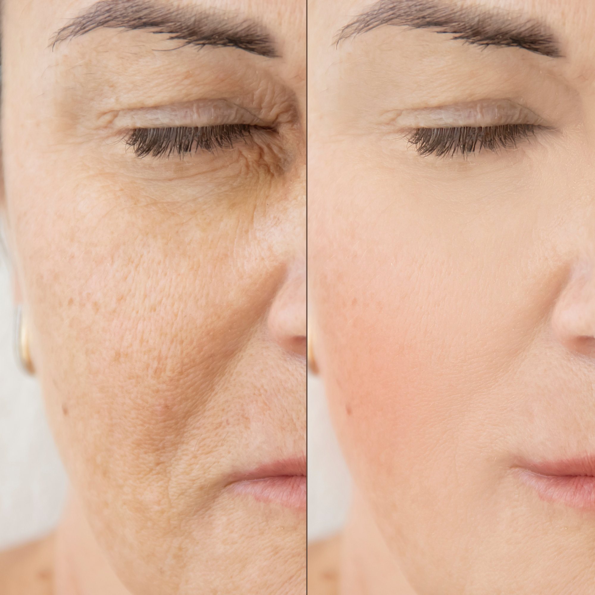 Belamax Collagen Booster Set - Anti-Aging Tages- & Nachtcreme